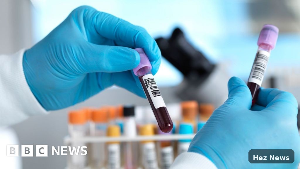 England Advances in Fight Against Hepatitis C