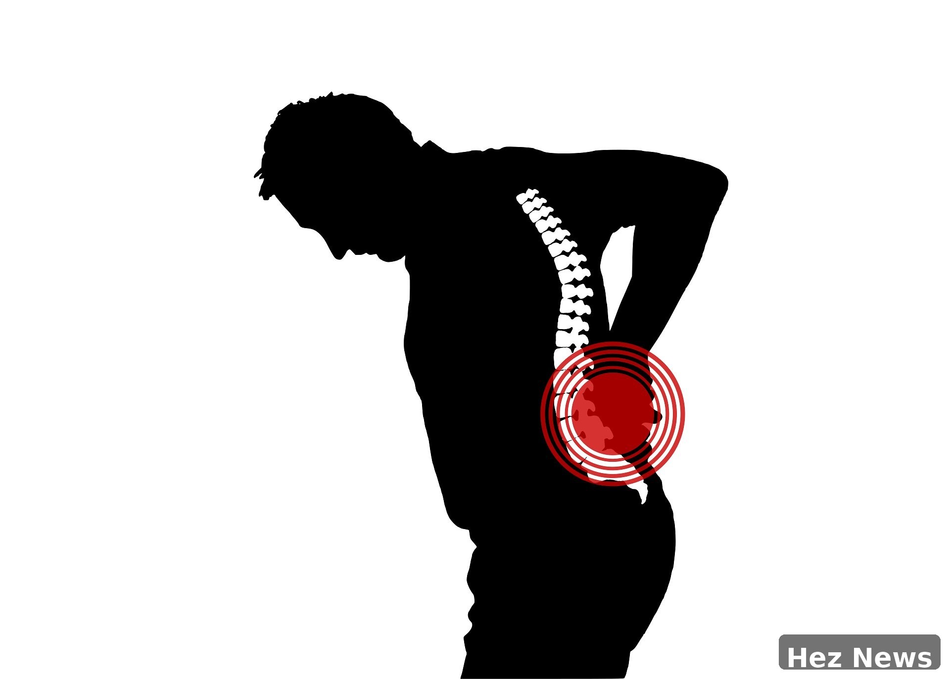 Low Back Pain: Little Evidence for Back Brace Effectiveness